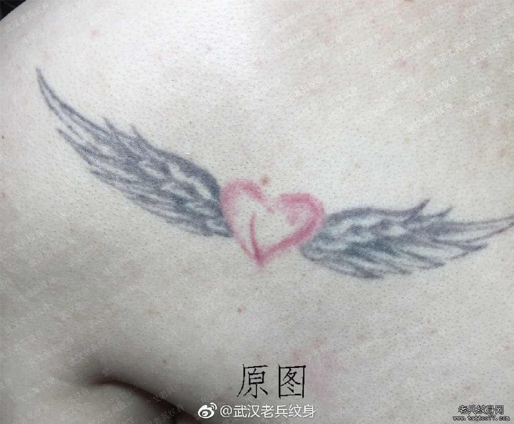 胸前爱心翅膀皮秒洗纹身过程